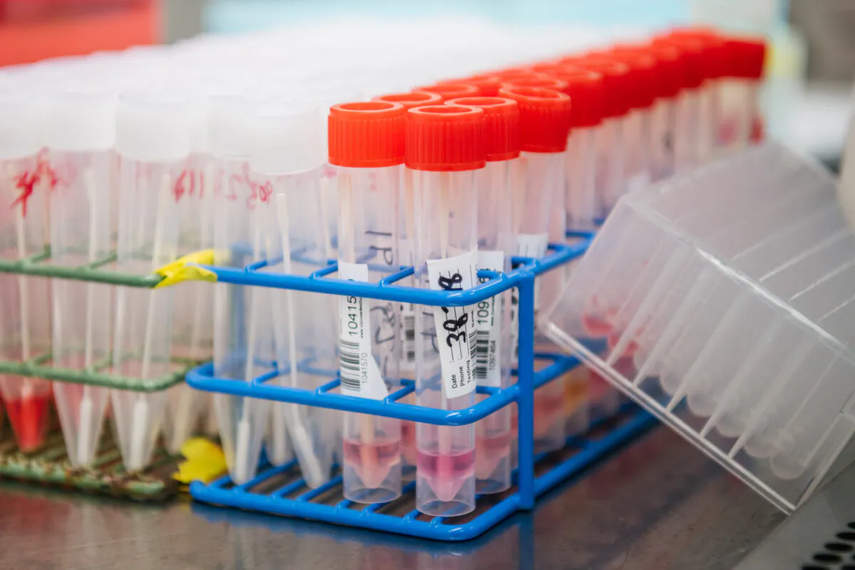 COVID-19 sample viles at the a testing lab in Houston, Texas on Aug. 13, 2021. (Brandon Bell/Getty Images)