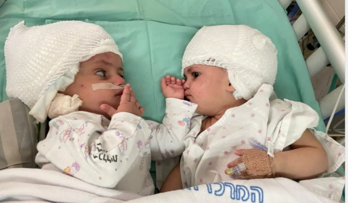Formerly conjoined twins look at one another after having undergone separation surgery at Soroka Medical Centre, Beersheba, Israel, on Sept. 5, 2021. (Soroka Medical Centre/Handout via Reuters)
