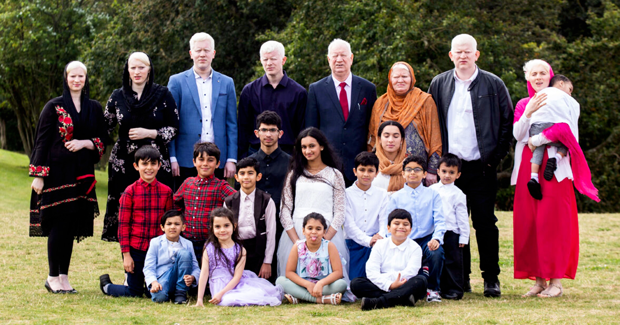 British-Asian Clan With 15 Albinos Might Be the World's Biggest Family With the Condition - Vimarsana News