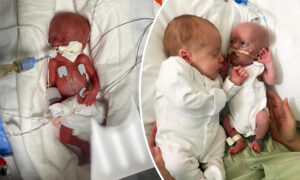 Mom Gives Birth to 1-in-2-Million Twins With Down Syndrome: ‘They Have a Beating Heart, They Do Everything We Do’