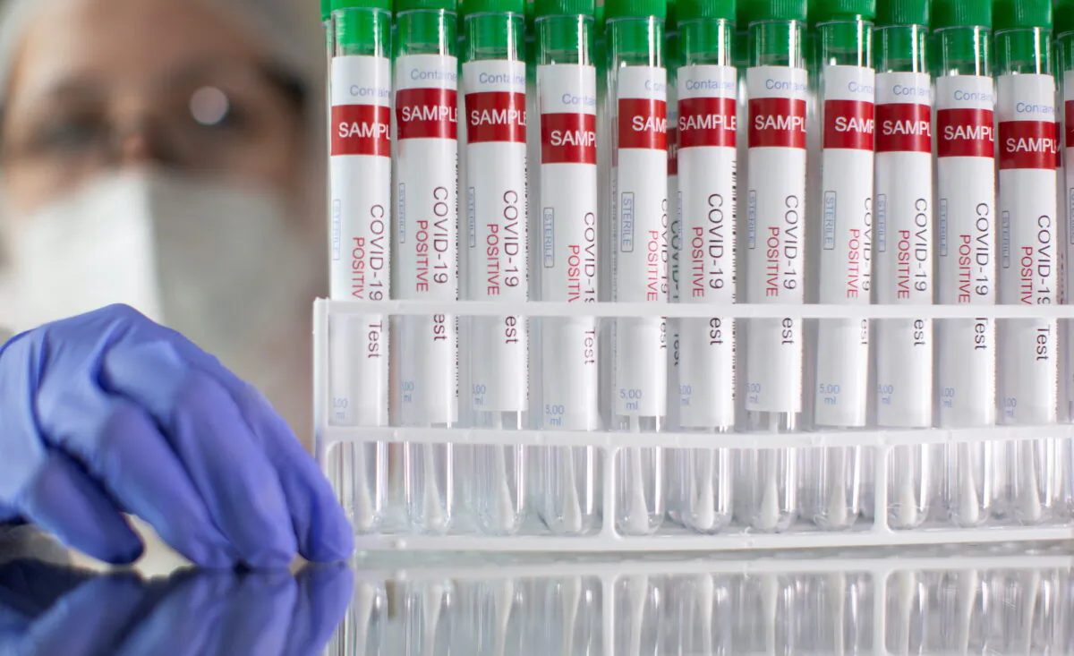 Test tubes labelled "COVID-19 Test positive" are seen in this illustration picture taken on March 10, 2021. (Dado Ruvic/Illustration/Reuters)