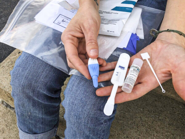 HIV Outbreak