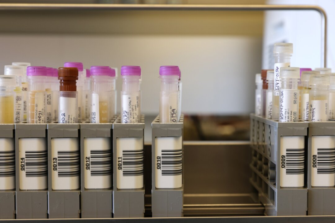 Samples from a clinical trial studying Novavax's COVID-19 vaccine, in Seattle, in this file photo. (Karen Ducey/Getty Images)