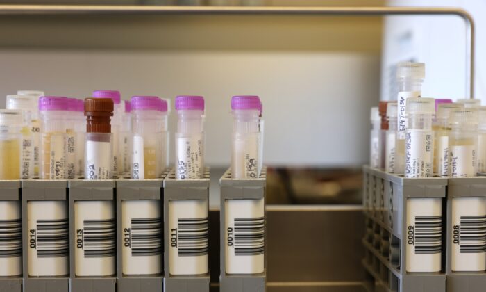 Samples from a clinical trial studying Novavax's COVID-19 vaccine, in Seattle, in this file photo. (Karen Ducey/Getty Images)