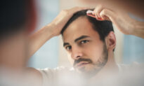 6 Ways to Reverse Hair Loss