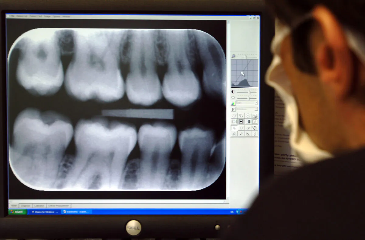 A dentist examines x-ray results. (PA)