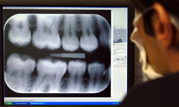 A dentist examines x-ray results. (PA)
