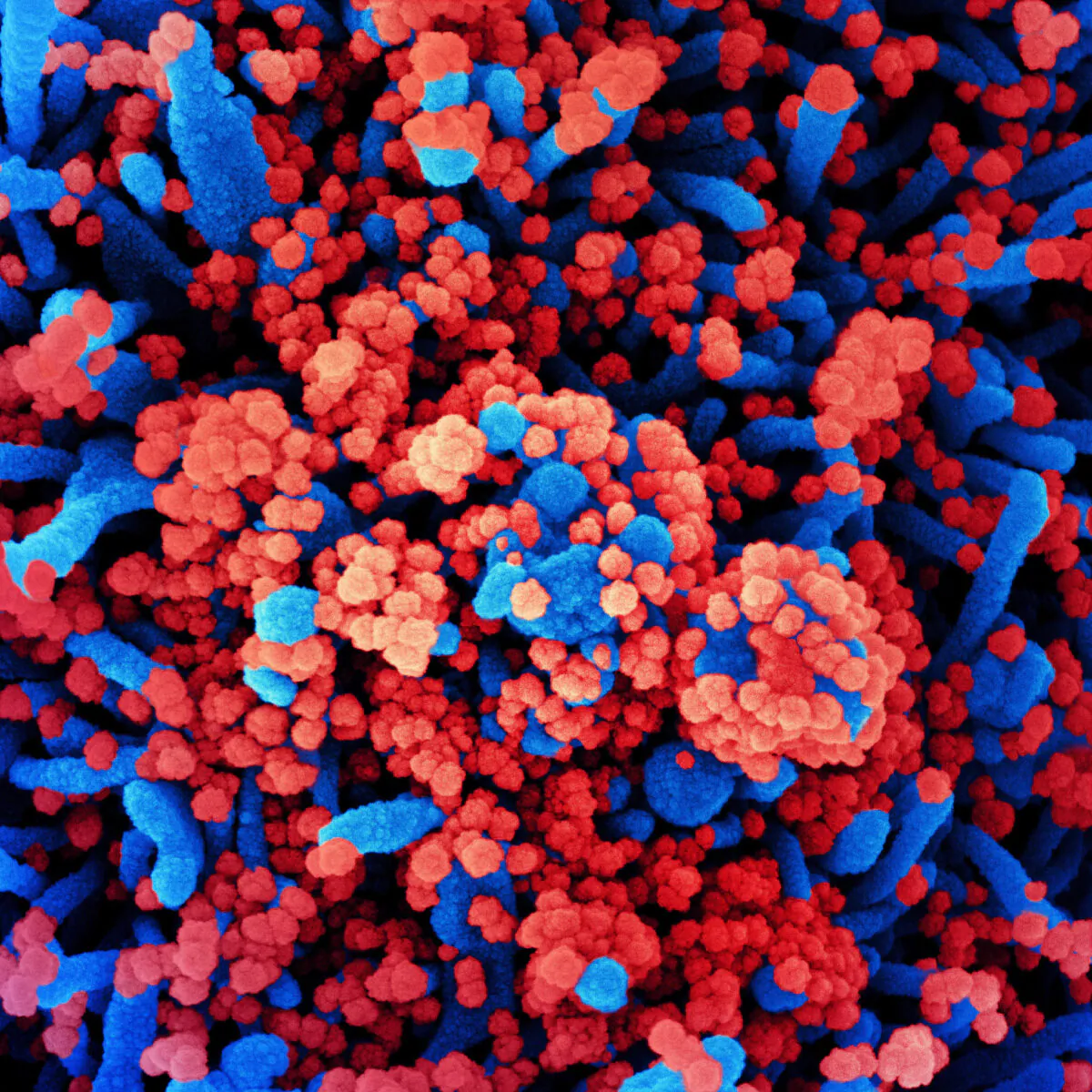 Undated colorized scanning electron micrograph of a cell (blue) heavily infected with COVID-19 particles (red), isolated from a patient sample at the NIAID Integrated Research Facility in Fort Detrick, Md., on Oct. 31, 2020. (NIAID)