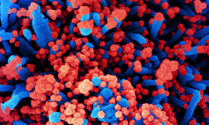 Undated colorized scanning electron micrograph of a cell (blue) heavily infected with CCP virus—also known as SARS-CoV-2—particles (red), isolated from a patient sample at the NIAID Integrated Research Facility in Fort Detrick, Md., on Oct. 31, 2020. (NIAID)