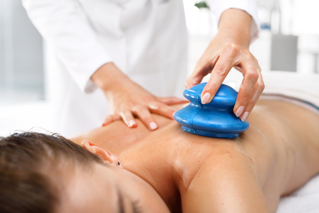 Traditional Chinese cupping of the back can be used to help relieve muscle spasms and restore the natural curve to the lower back. By Robert Przybysz/Shutterstock