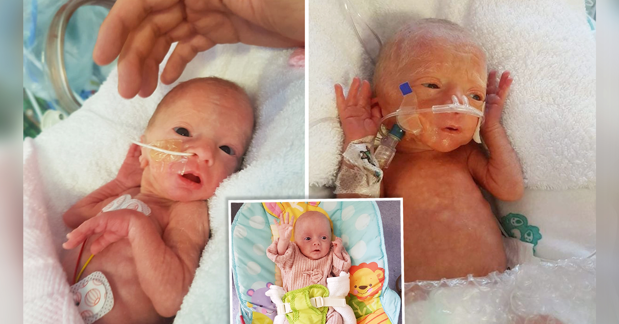 Baby Girl Born 13 Weeks Early Was Too Small for Doll Clothes, Now Thriving: 'Our Little Fighter' - Vimarsana News