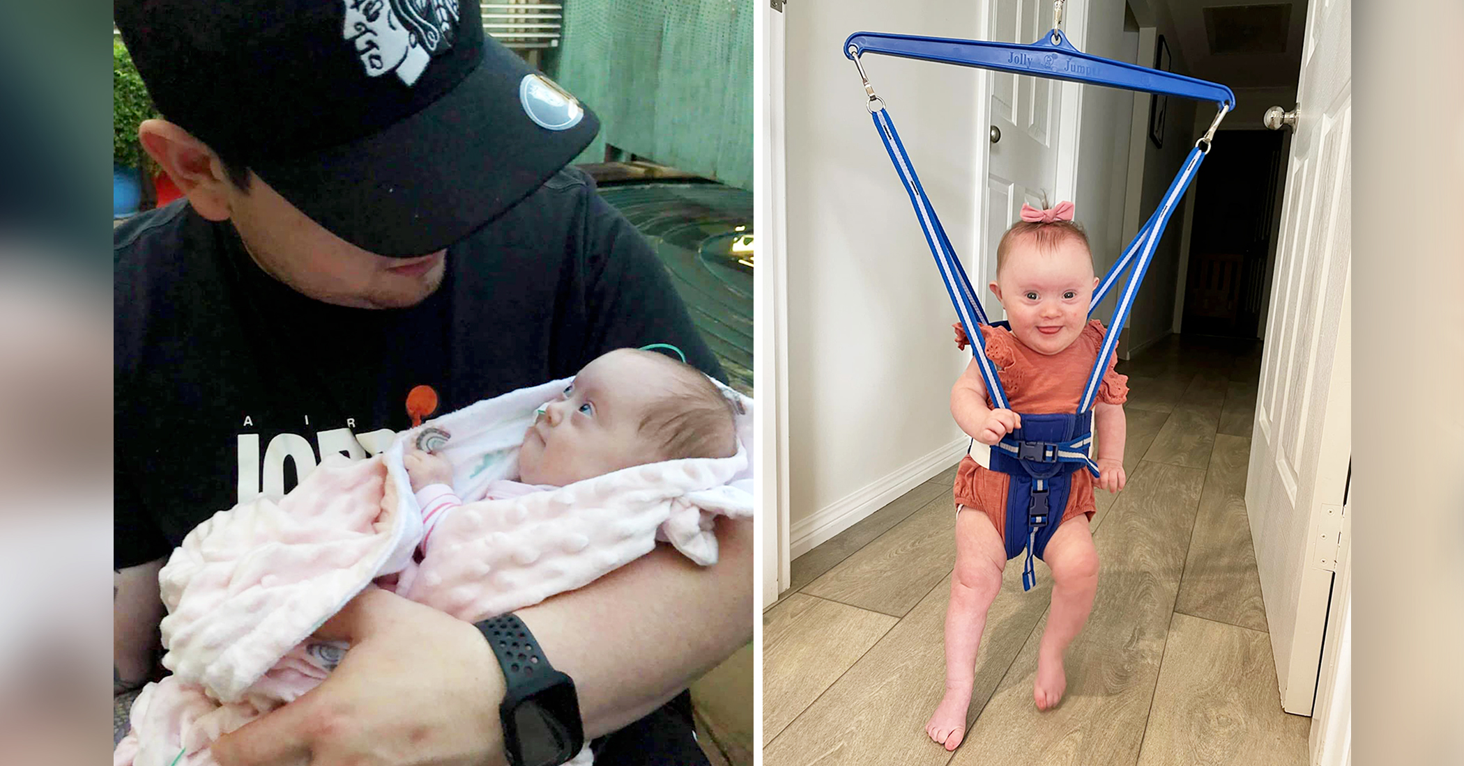 Doctor Schedules Abortion for Baby With Down Syndrome, Parents Refuse and Now She's Thriving - Vimarsana News
