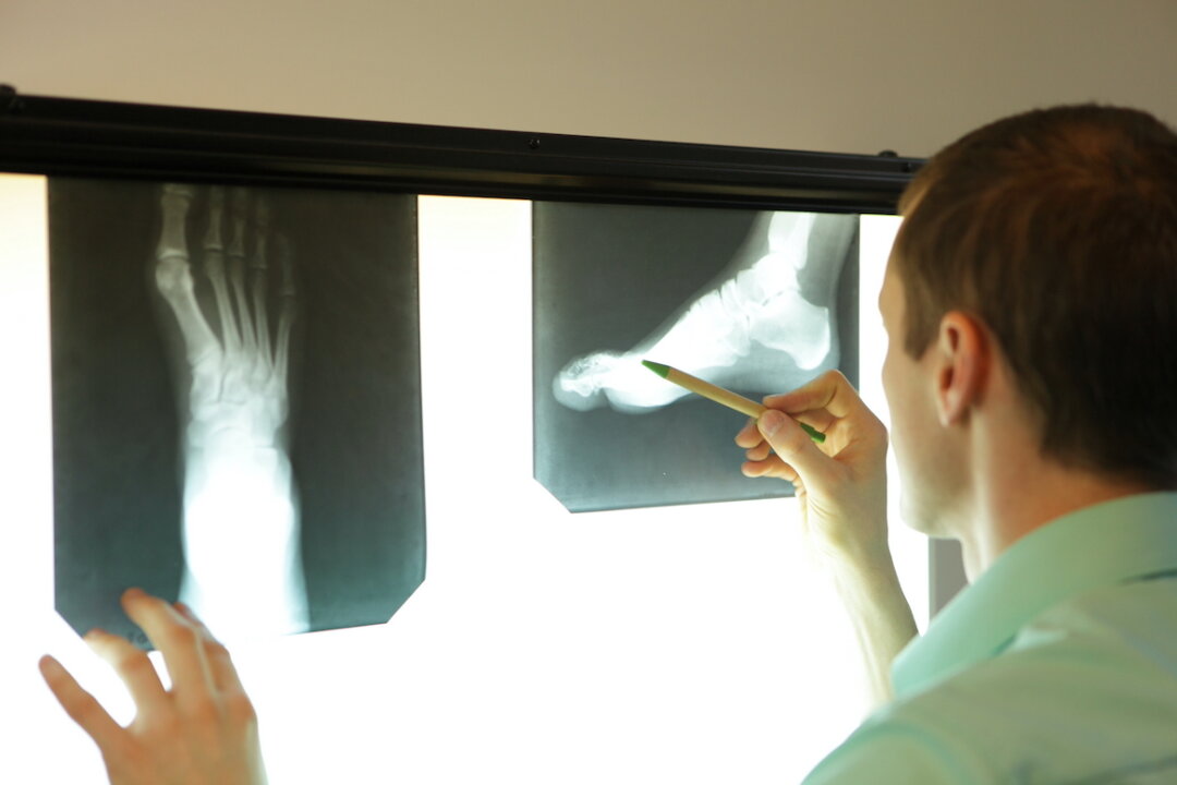 In the 1930s and '40s, shoe stores offered free X-rays of one's feet so customers could be entertained by seeing the bones in their feet. (Marcin Balcerzak/Shutterstock)