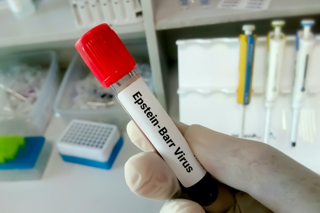 Harvard researchers have published findings that suggest Epstein-Barr virus, a member of the herpes virus family, is a likely cause for multiple sclerosis.(Saiful52/Shutterstock)