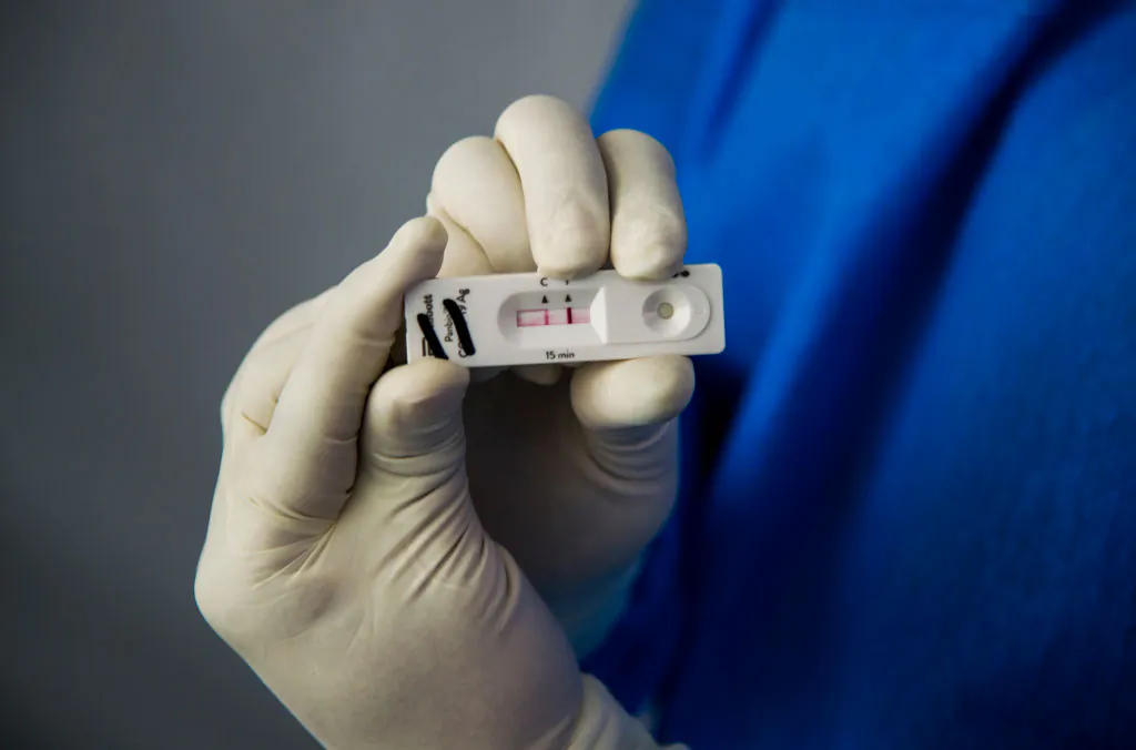 A Mexico City government health worker shows a positive test of a resident during a COVID-19 Rapid Antigen testing in Santa Ursula neighborhood, Mexico City, on Nov. 26, 2020. (Claudio Cruz/AFP via Getty Images)