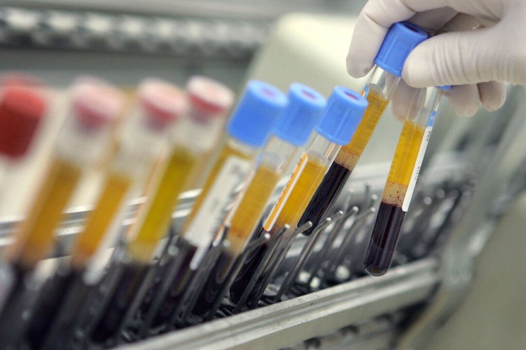 A team led by researchers from Taiwan found that demethylating drugs for a group of blood cancers may upregulate the SALL4 oncogene. This photo shows human blood samples on an automated testing line. (David Silverman/Getty Images)