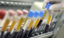 Epstein-Barr Virus May Be Leading Cause or Trigger of Multiple Sclerosis, New Harvard-Led Study Suggests
