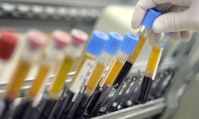 File photo of human blood samples on an automated testing line. (David Silverman/Getty Images)