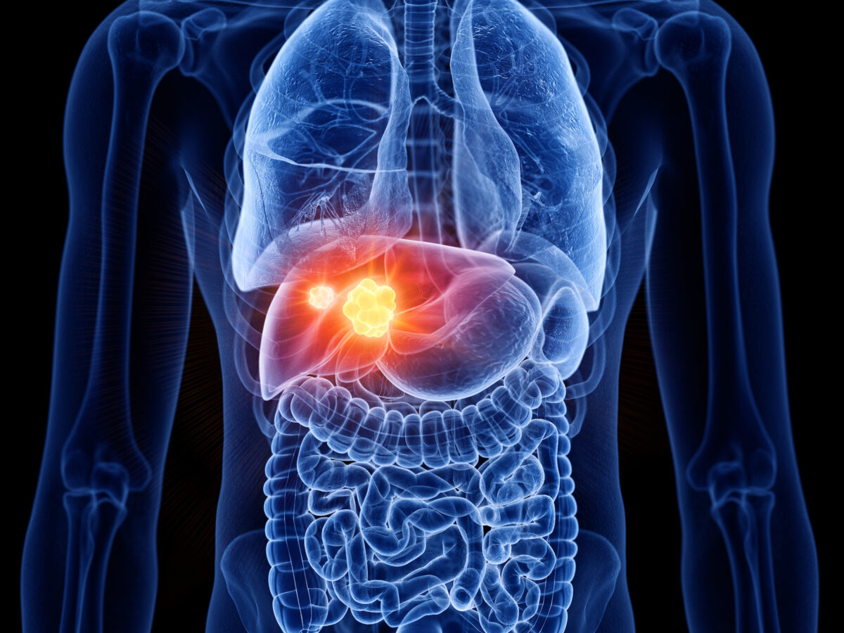 These Five Substances Protect Your Liver