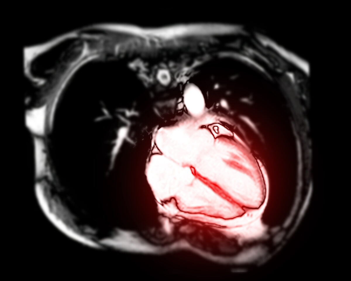 Magnetic resonance imaging of the heart (Radiological imaging/Shutterstock)