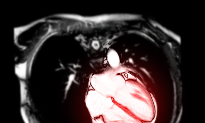 Magnetic resonance imaging of the heart (Radiological imaging/Shutterstock)