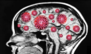 How COVID-19 Might Increase Risk of Memory Loss and Cognitive Decline