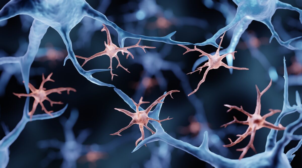 The cells which clear Alzheimer’s plaques from the brain follow a 24-hour circadian rhythm. By ART-ur/Shutterstock
