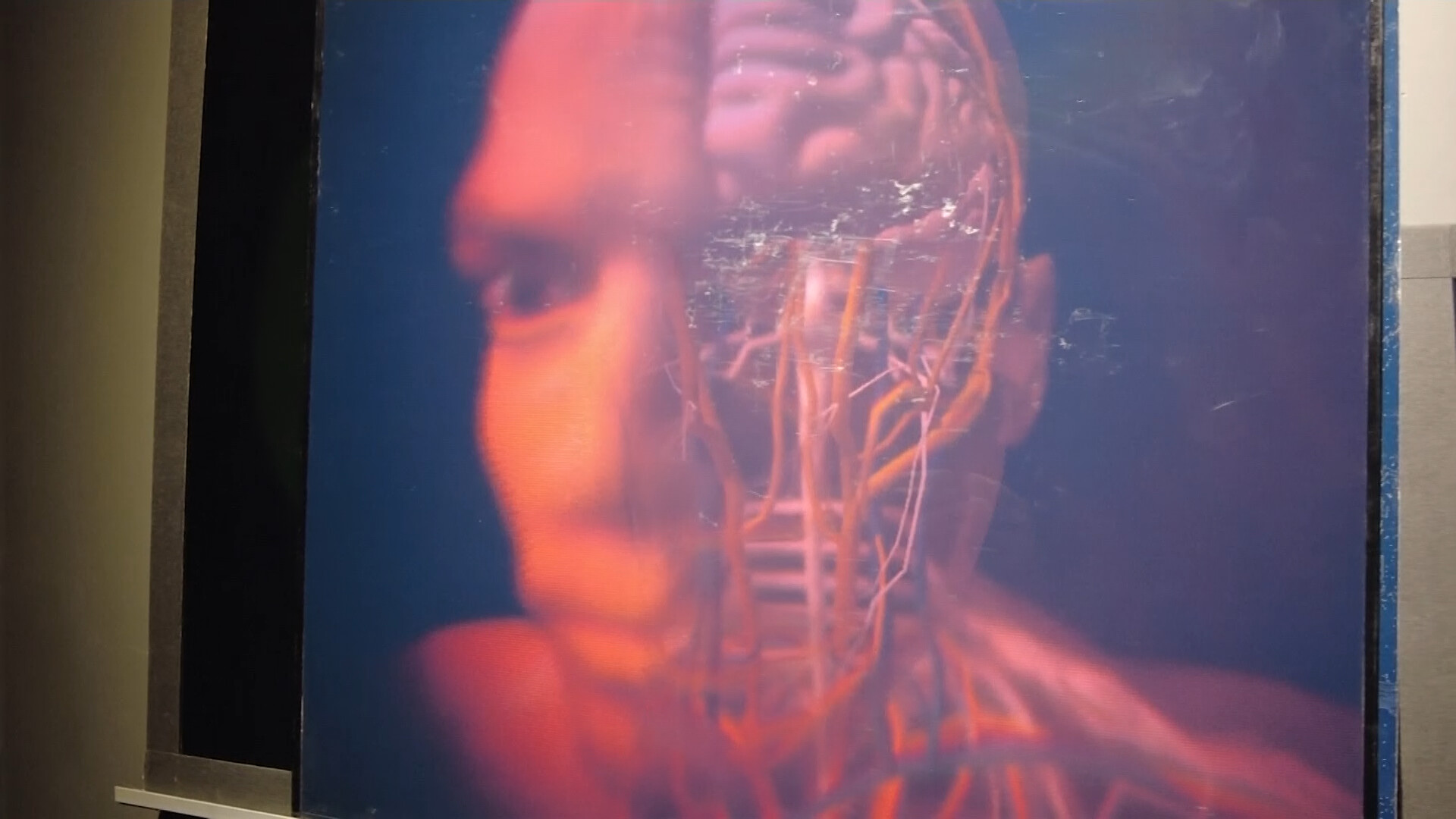 Revival of Hologram Technology for Medicine and Security - Vimarsana News