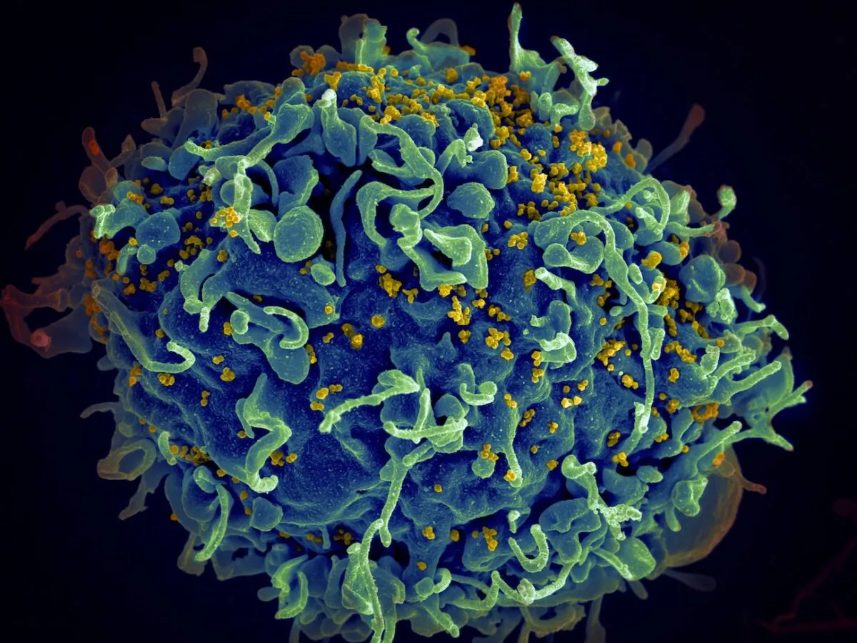 The human immunodeficiency virus (yellow) infecting a human cell. (National Cancer institute/Unsplash)