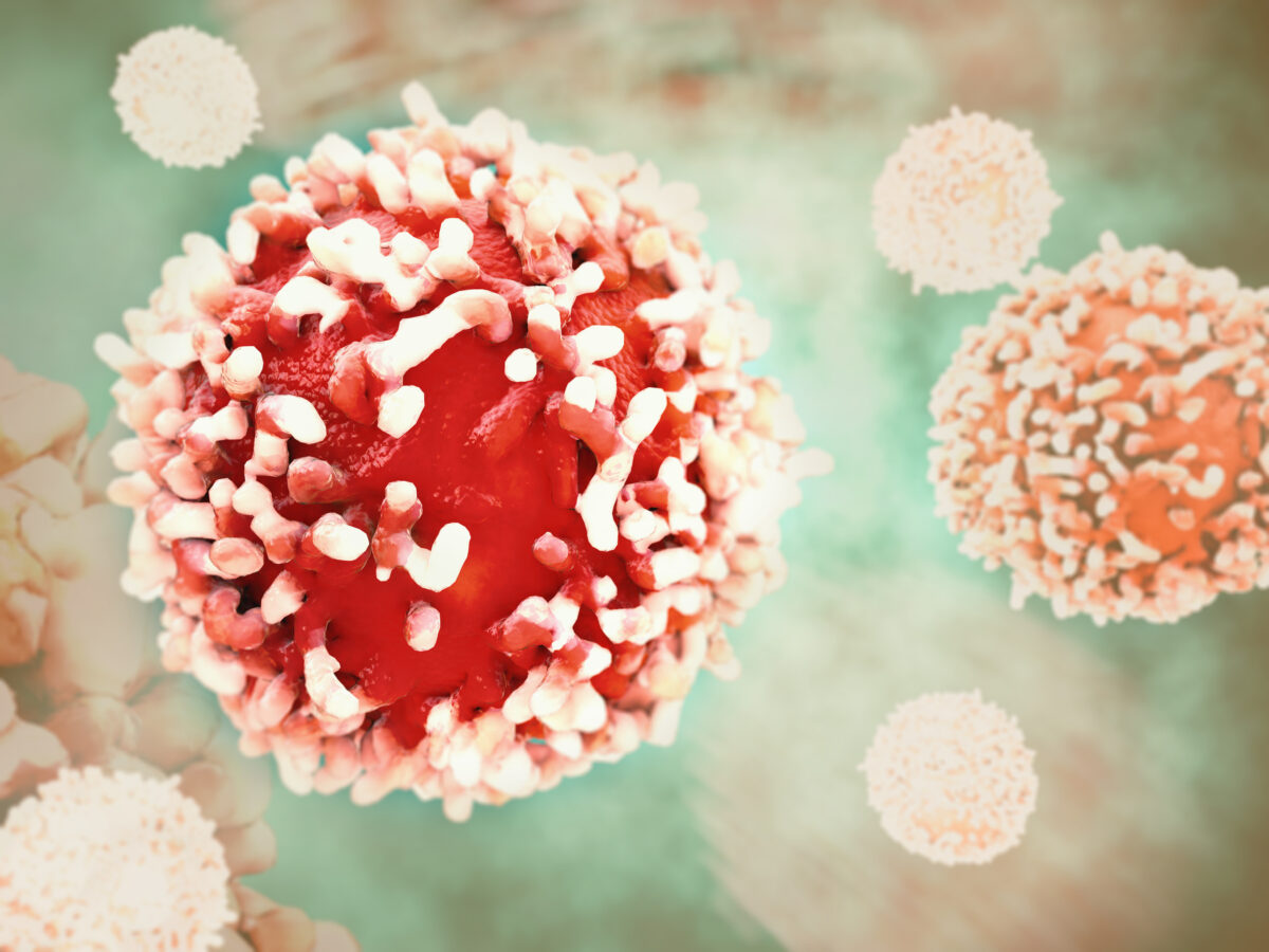 Cancer Cell in human body By Crevis/Shutterstock