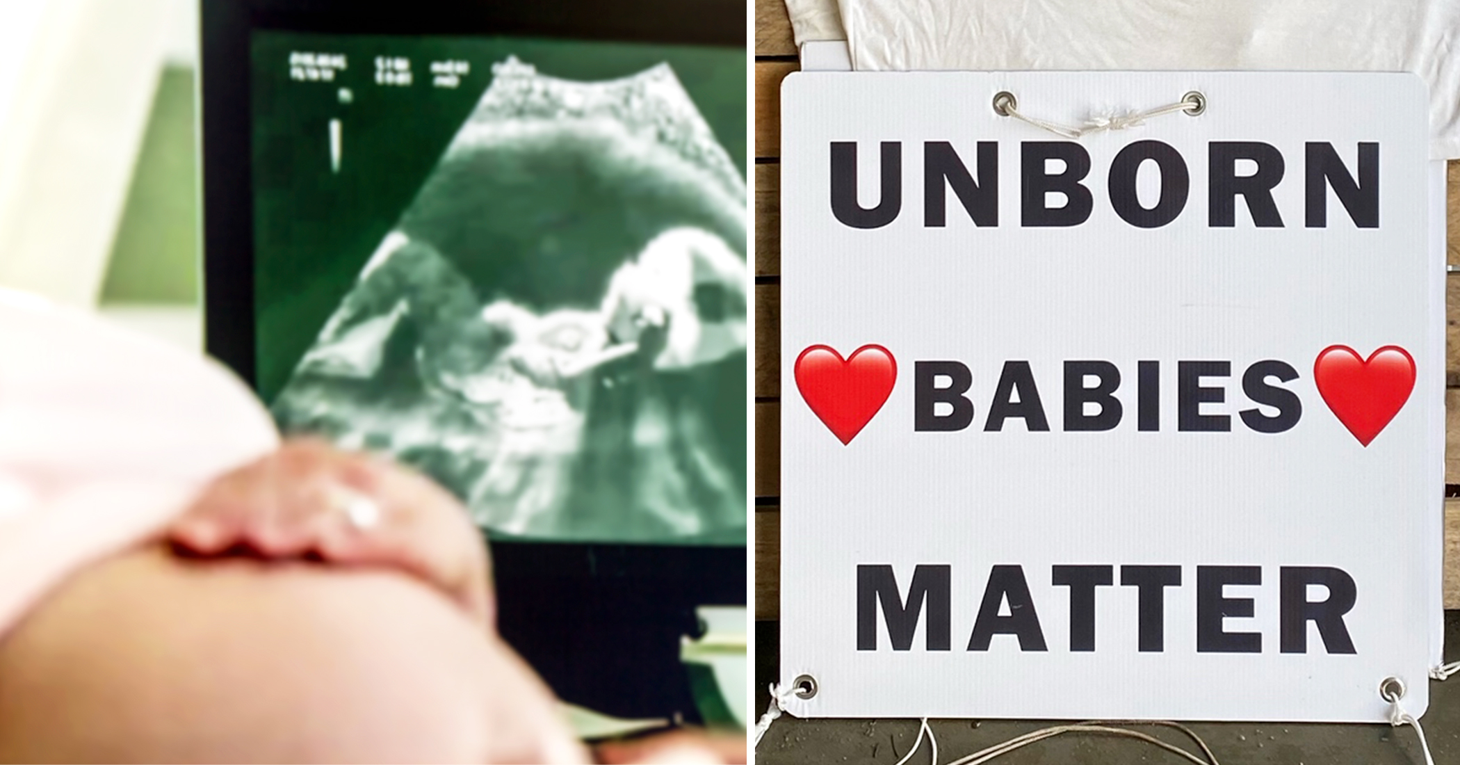 Pregnant Woman Rejects Abortion After 71-Year-Old Man's Pro-Life Sign Convinces Her - Vimarsana News
