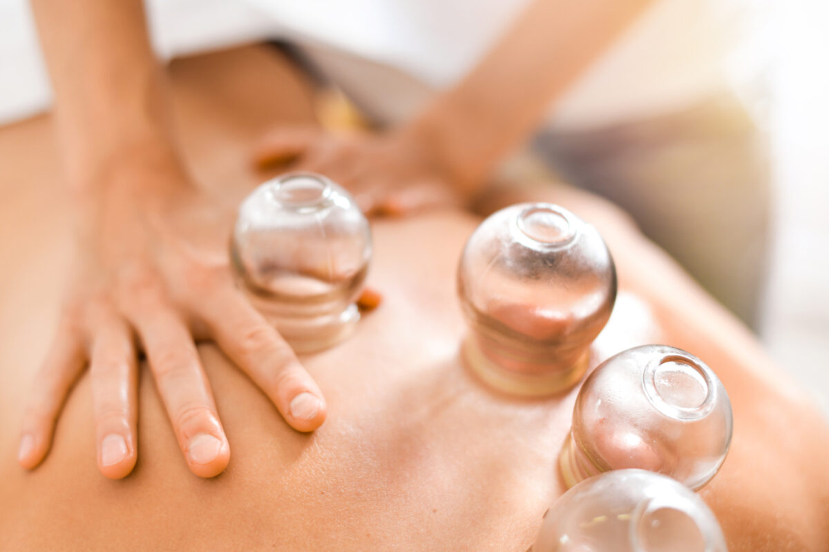 Cupping Treatments and Olympic Athletes