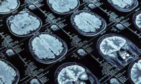 Link Between Sugar and Alzheimer’s Strengthens
