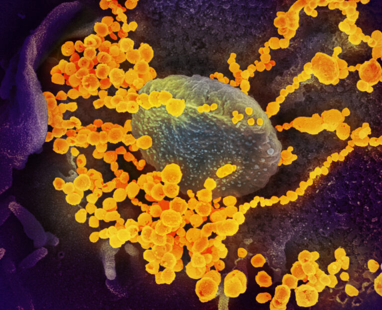 An electron microscope image shows SARS-CoV-2 (round gold objects), which causes COVID-19, emerging from cultured cells. (NIAID)