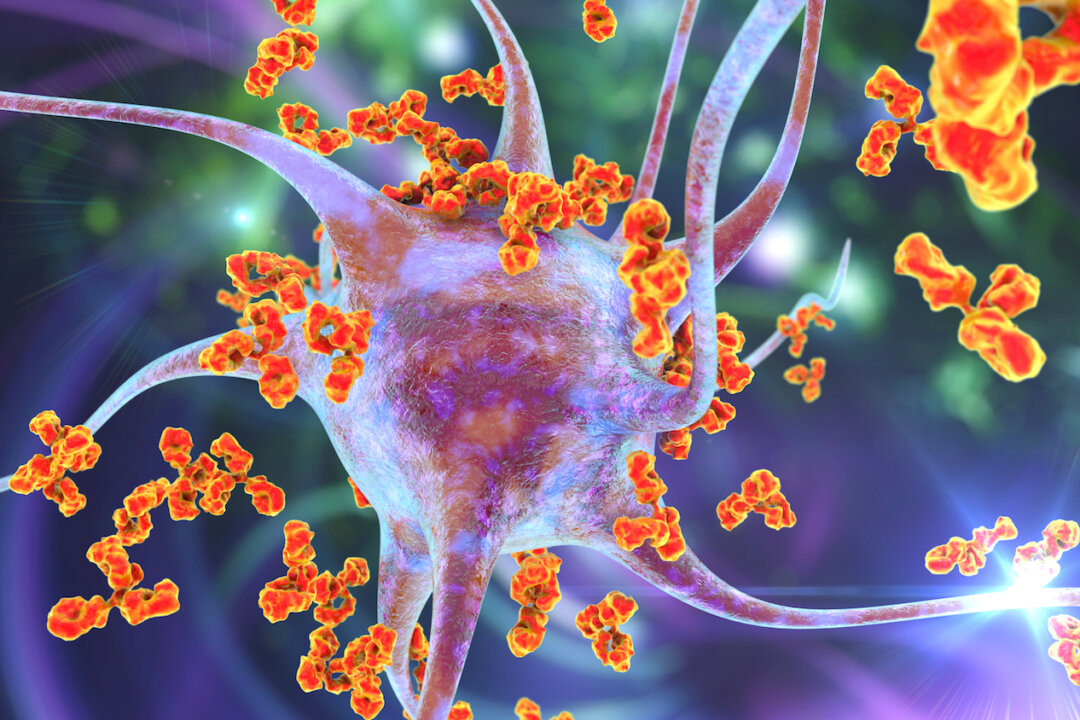 Antibodies attacking neuron By Kateryna Kon/Shutterstock