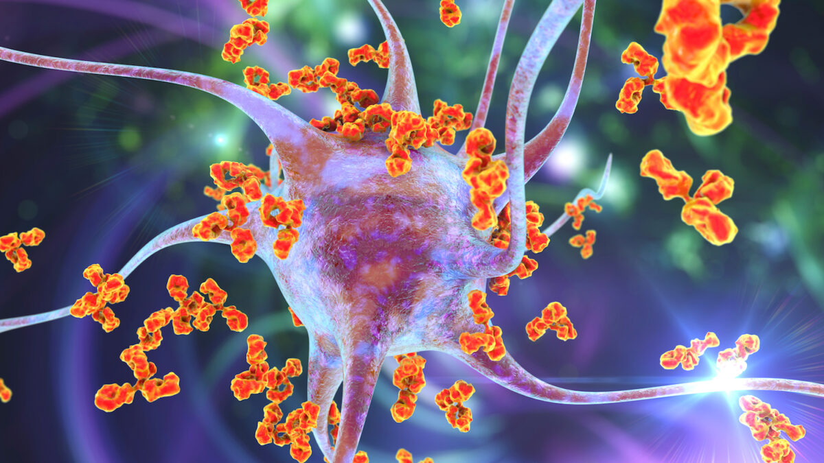 Antibodies attacking neuron By Kateryna Kon/Shutterstock