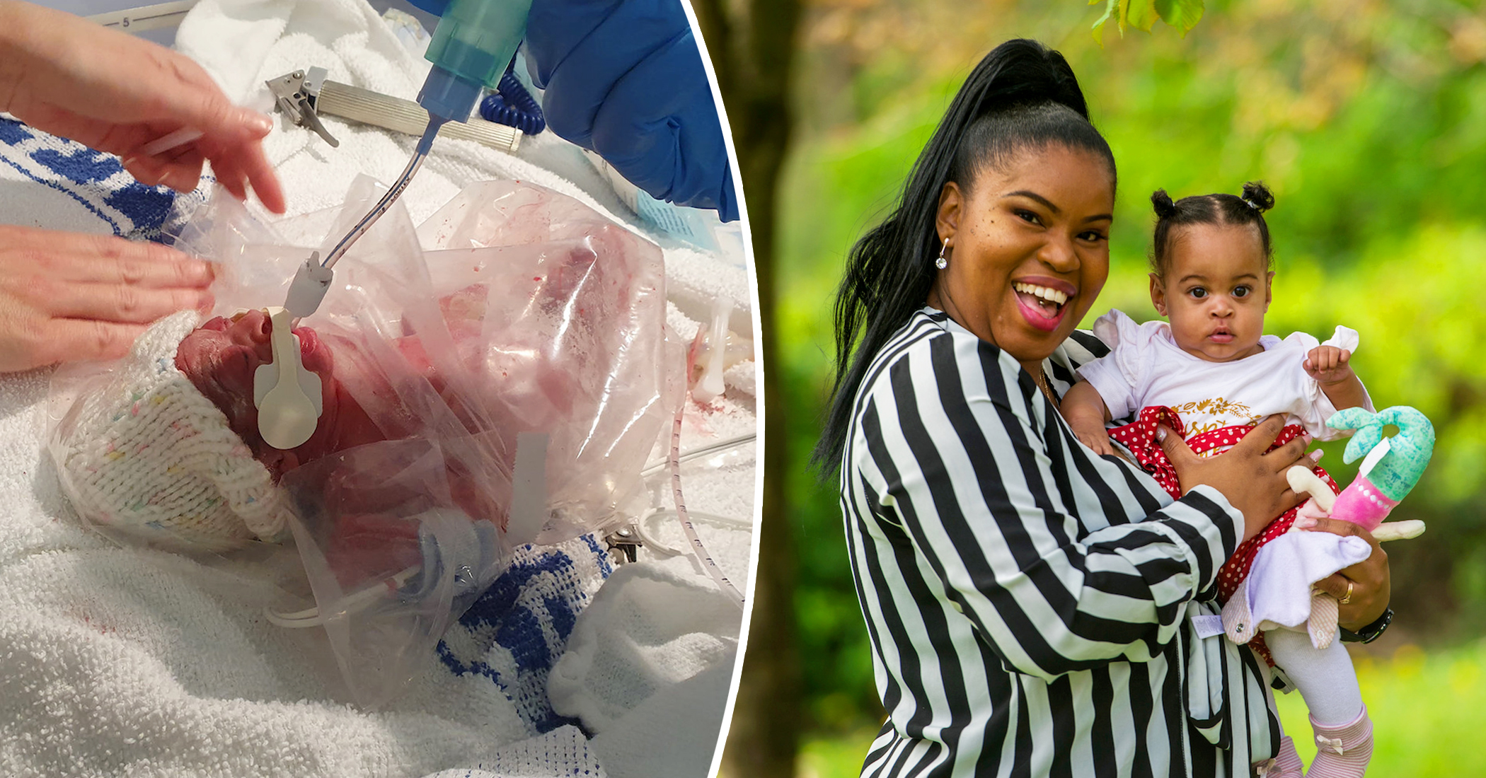 Preemie Born At Weeks Was Put Into A Sandwich Bag Defies Odds And Is Now Thriving