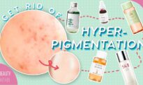Best Ways to Reduce Hyperpigmentation and Dark Spots: Ingredients, Products, and Natural Remedies