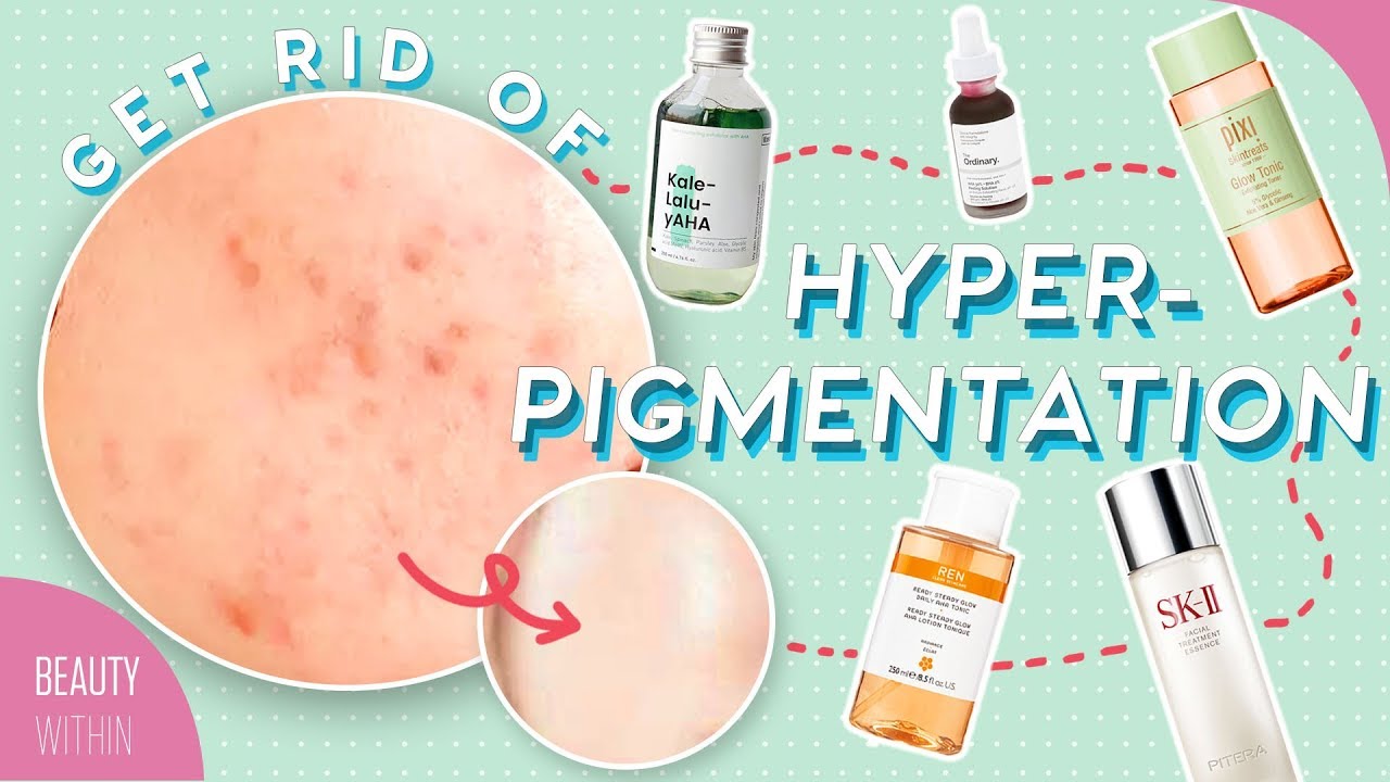 Best Ways to Reduce Hyperpigmentation and Dark Spots: Ingredients, Products, and Natural Remedies - Vimarsana News