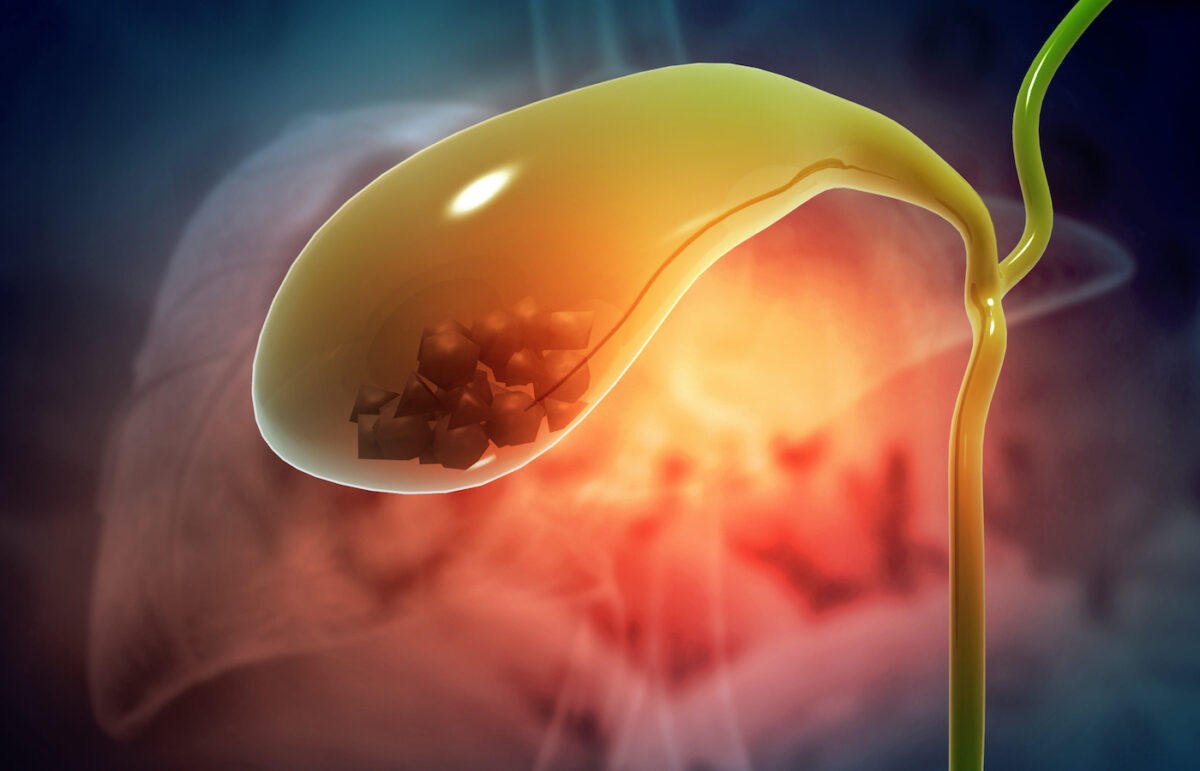 Is Your Gallbladder Causing Your Symptoms? Here’s How to Flush It