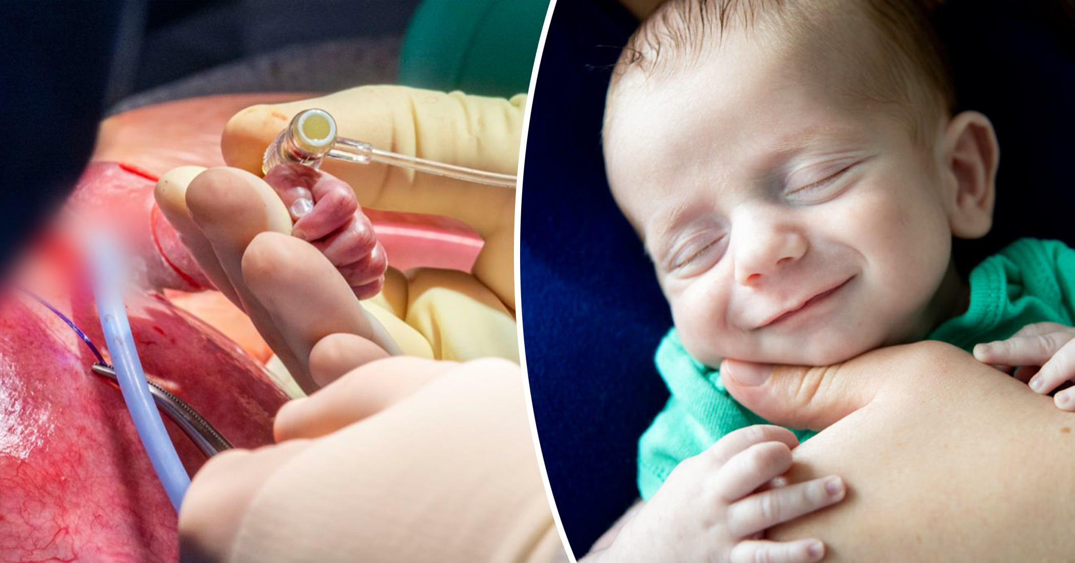Unborn Baby Partially Removed from Womb for Heart Surgery, Placed Back, Born 10 Weeks Later - Vimarsana News