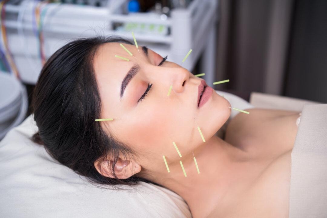 Cosmetic surgery offers a quick way to look younger, but for those looking for firmer skin and a healthier glow, cosmetic acupuncture may be a safer way to go. (BaLL LunLa/Shutterstock)