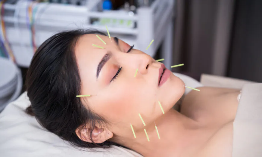 Cosmetic surgery offers a quick way to look younger, but for those looking for firmer skin and a healthier glow, cosmetic acupuncture may be a safer way to go. (BaLL LunLa/Shutterstock)