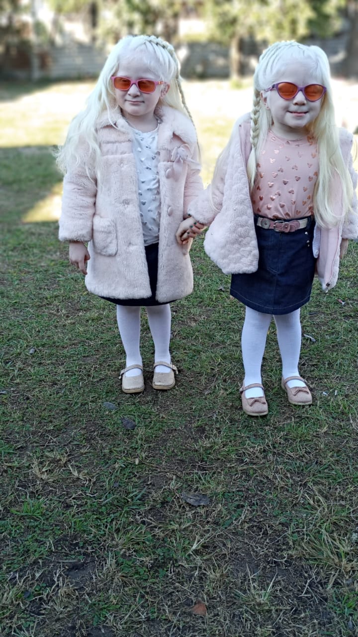 Parents Give Birth to Rare Albino Twins, Share Family Life With Their  4-Year-Old Daughters