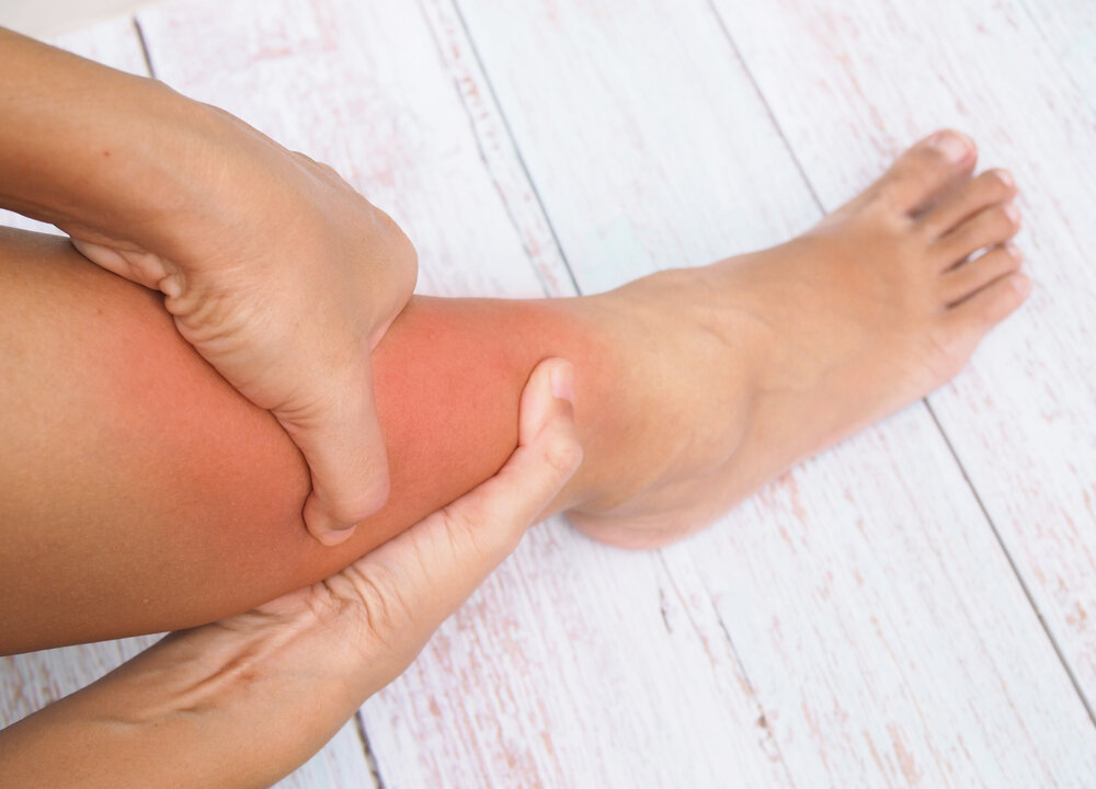 Swelling can be painful, esp in the legs if we also have to walk while swollen. (Shutterstock)