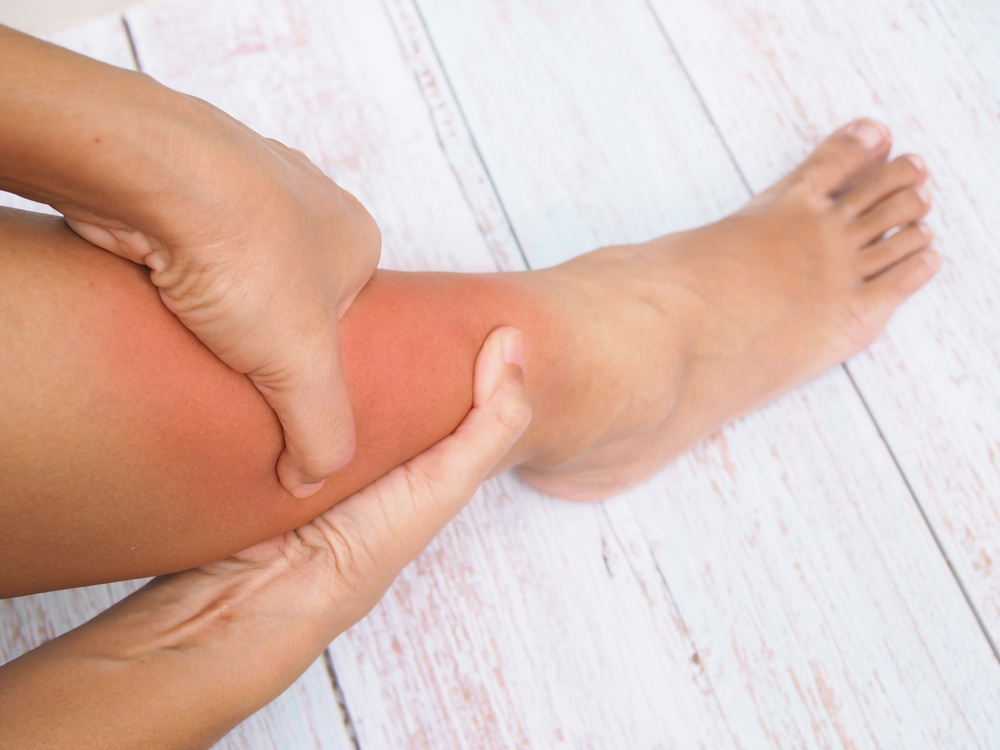 Swelling can be painful, esp in the legs if we also have to walk while swollen. (Shutterstock)