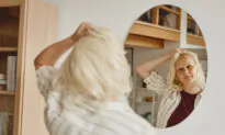 What Is Alopecia? It’s No Laughing Matter for Millions of People