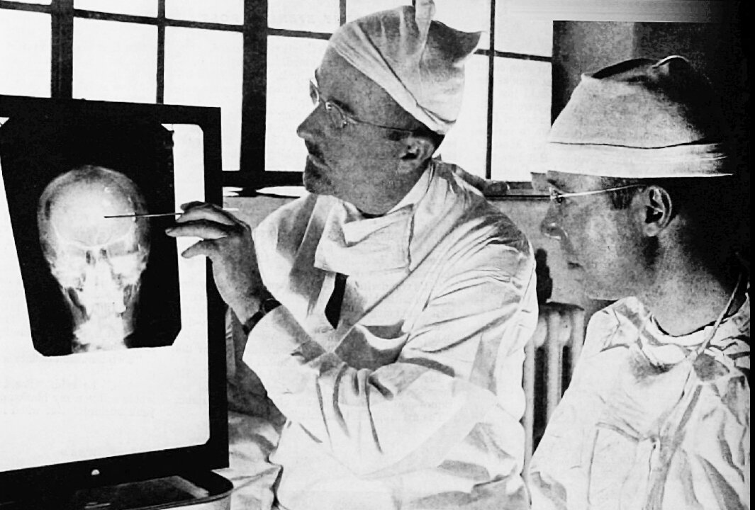 "Dr. Walter Freeman, left, and Dr. James W. Watts study an X ray before a psychosurgical operation. Psychosurgery is cutting into the brain to form new patterns and rid a patient of delusions, obsessions, nervous tensions and the like. (Wikipedia)