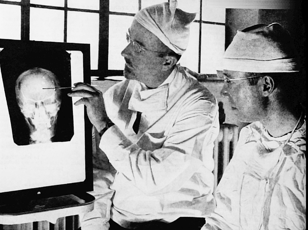 "Dr. Walter Freeman, left, and Dr. James W. Watts study an X ray before a psychosurgical operation. Psychosurgery is cutting into the brain to form new patterns and rid a patient of delusions, obsessions, nervous tensions and the like. (Wikipedia)
