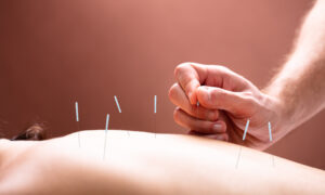 Study: Acupuncture Helps Relieve Insomnia Safely and Effectively
